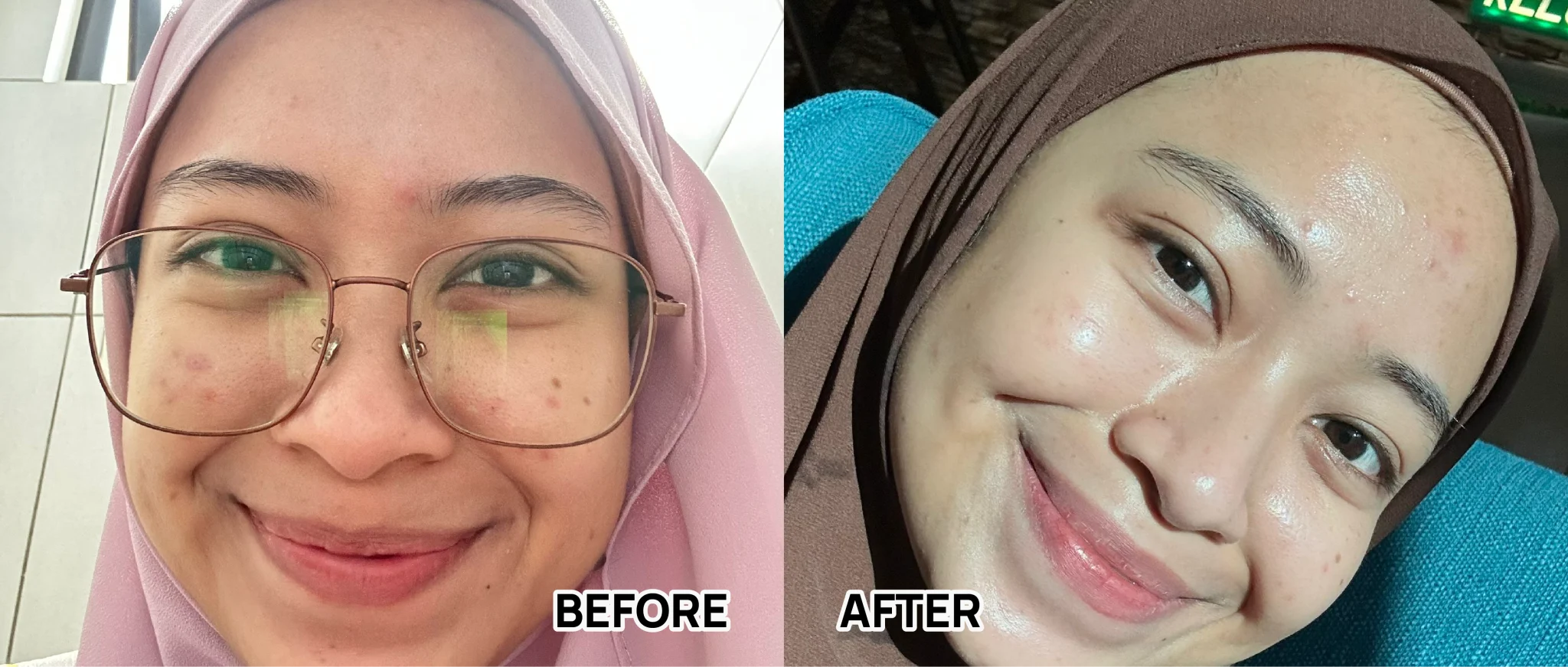 BEFORE AFTER-53