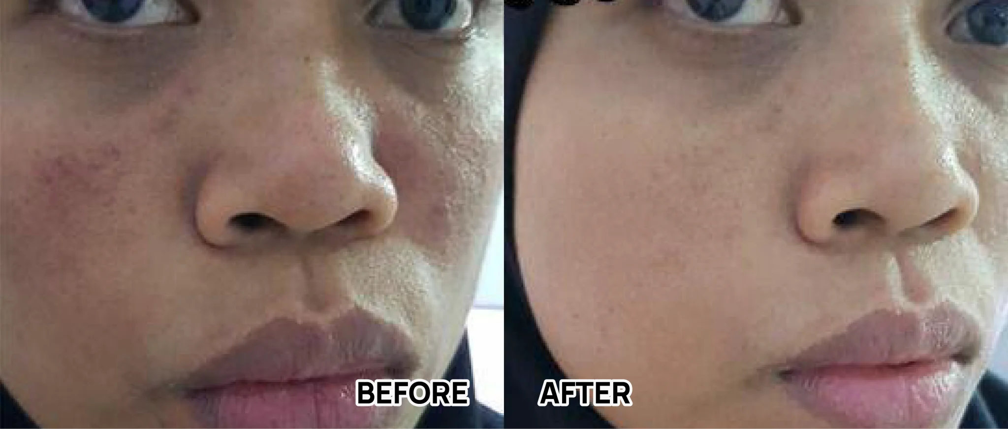 BEFORE AFTER-54