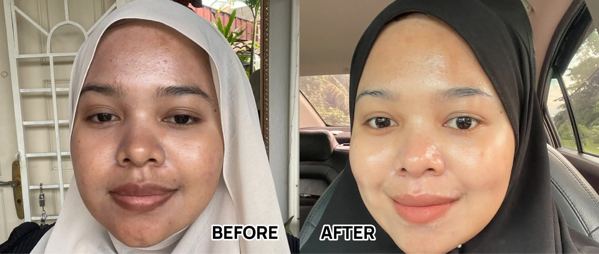 BEFORE AFTER-55