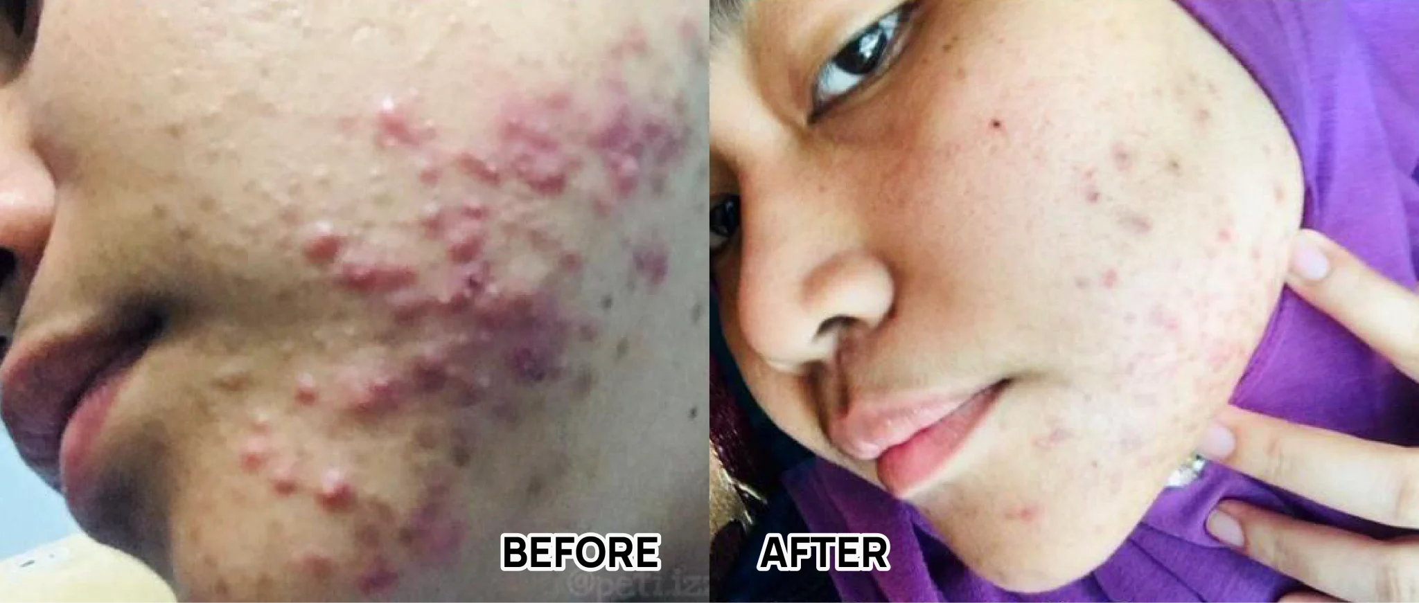 BEFORE AFTER-56