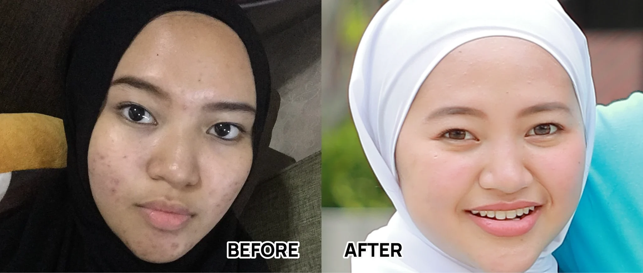 BEFORE AFTER-57