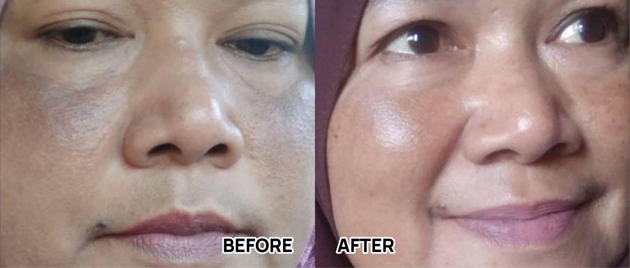 BEFORE AFTER-58
