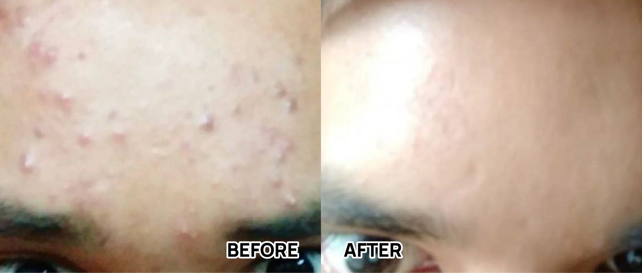 BEFORE AFTER-59