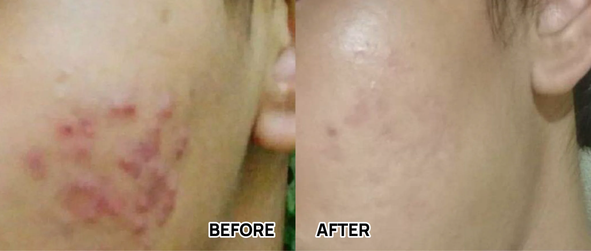 BEFORE AFTER-60